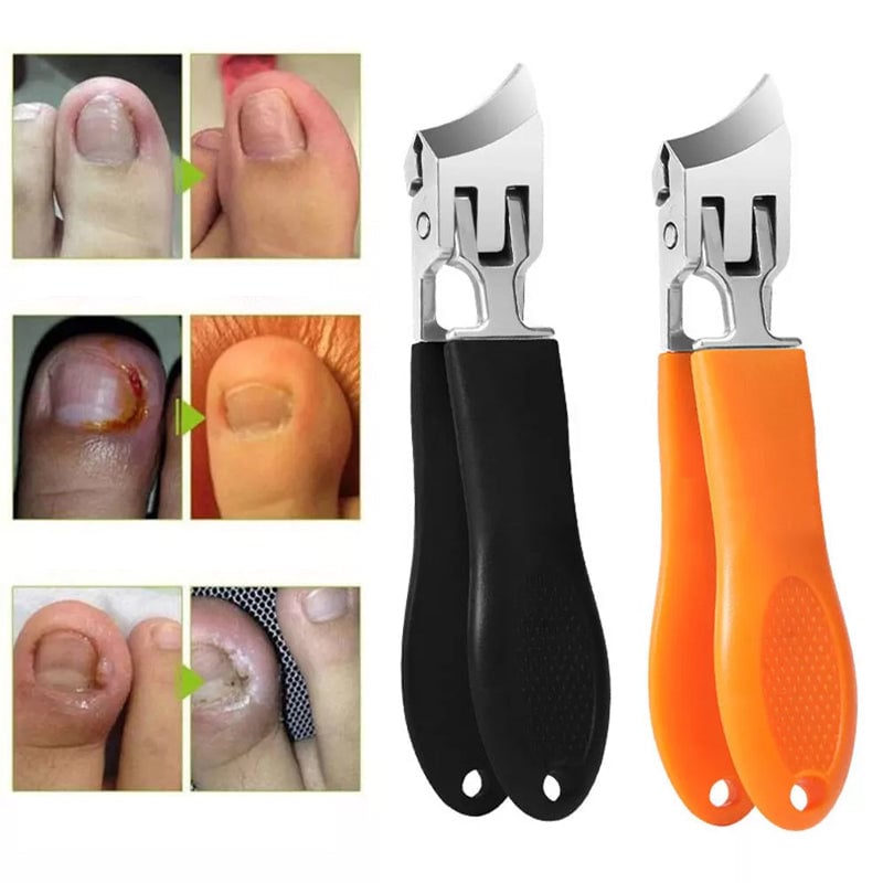 🔥Limited Time Buy 1 Get 1 Free🔥Wide Jaw Opening Anti-Splash Slanted Nail Clipper